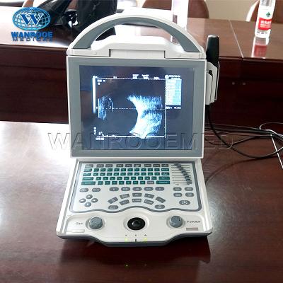 China US101 Metal Cheap Full Metal Eye Scanner Portable Digital A/B Ultrasound Ophthalmic Equipment Price for sale