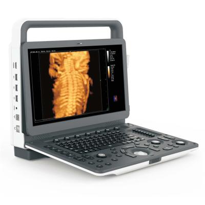 Cina Portatile 4D Ultrasound Machine Interfaccia dati medici Video VGA DICOM3.0 USB Port Stampante in vendita