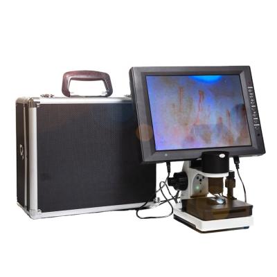 China Clinical Microcirculation Subhealth Detector Blood Capillary Microscope 12 Inch Detection Machine for sale