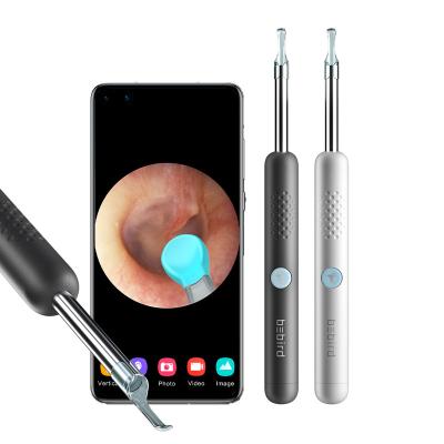 China Ear Wax Ear Camera Otoscope Ear Spoon Remover Wifi Endoscope Camera Visual Radio Removal for sale