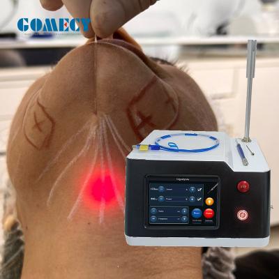 China Máquina de Endolift Laser de resfriamento por ar 400μM 600μM 800μM 980nm1470nm Máquina de Soldadura por Laser à venda