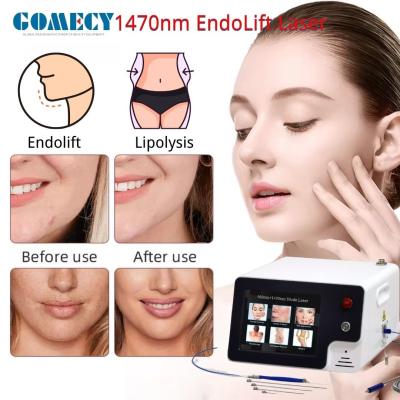 China Laser Endolift 1470nm 980nm Dual Wavelengths Facial Beauty Laser EVLT ENT PLDD Varicose Removal Machine for sale