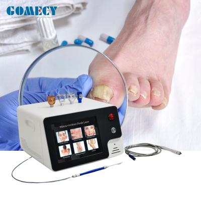 China 980nm Nail Fungus Removal Laser Machine Non Invasive Type Laser Treatment For Nail for sale