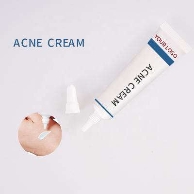 China Whitening Acne Cream Fine Peeps Repair Barrier Get Rid of Acne Salicylic Acid Acne Cream for sale