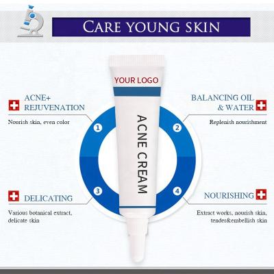 China Whitening Intensive Acne Cream Oil Control Acne Treatment Repair Remove Pimples Acne Cream for sale