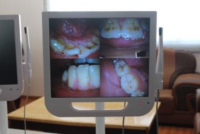 China Scharfes 17-Zoll hohes - Definition LCD-Monitor mit 8G Scheibe, zahnmedizinische Intramundkamera zu verkaufen