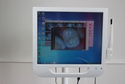 China Monitor LCD de la pantalla táctil 17Inch Japón con la intra cámara dental oral en venta