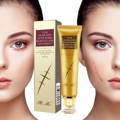 China Wholesale Natural Anti Aging Effectively Remove Dark Spot And Pimples Scars Acne Removal Cream for sale