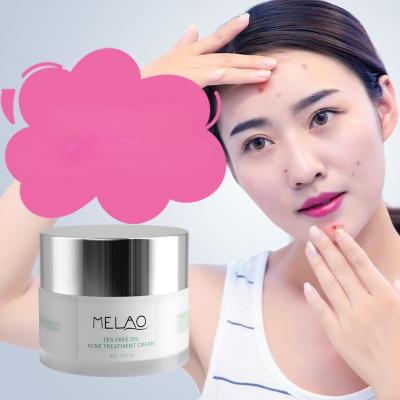 China Moisturizer Acne Cream To Stay All Night Muscle Moisturizing Cream To Fade Acne Marks for sale