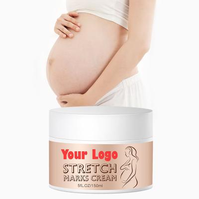 China Skin Revitalizer OEM Private Label Stretch Mark Cream Stretch Marks Removal Cream Maternity Anti Aging Skin Repair Remove Pregnancy Marks Cream for sale