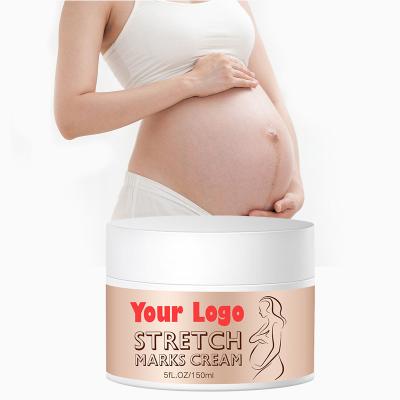 China Postpartum Deep Skin Revitalizer OEM Private Label Acne Scar Removal Anti Aging Maternity Repair Skin Cream Remove Pregnancy Scars Cream for sale