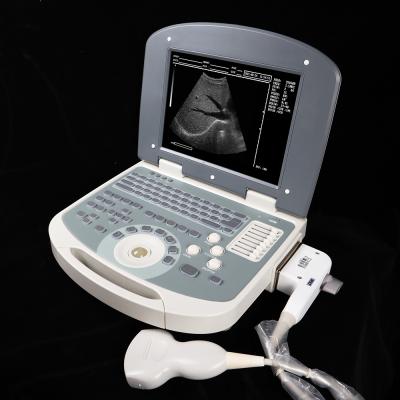 China Notebook Portable Ultrasound Scanner Black And White B/W Metal MDK 860 Ultrasound Machine for sale