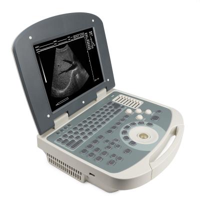 China 2021 metal ultrasound mdk 860 laptop ultrasonic scanner united black and white ultrasound for medical care for sale