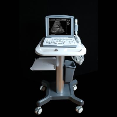 China MDK-660D Metal Ultrasound Scanner Ultrasound Black And White Diagnosis System With Built-in Battery for sale