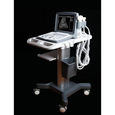 China Metal United Ultrasound MDK 660 B Black White Ultrasound Scanner Machine for sale