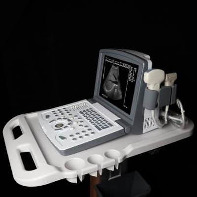 China Metal OEM B Ultrasound Scanner Ultrasound Instruments Laptop Medical Ultrasound Machine for sale