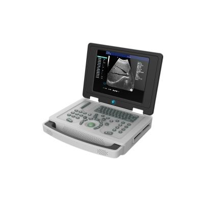 China United Metal Ultrasound Laptop B/W 2021 Ultrasound Machine For Medical Instrument for sale