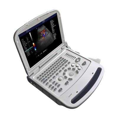 China Portable Solid Color Doppler Echo 2021 Portable Metal Doppler Ultrasound Machine MDK870 Laptop Color Ultrasound Machine for sale