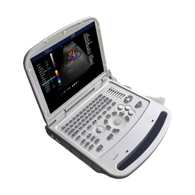 China Metal United Ultrasound MDK870 Portable Ultrasound Machine Mindray Color Doppler Product for sale