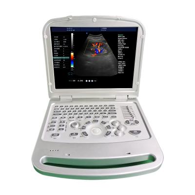 China 2021 metal ultrasound mdk 870 united color doppler laptop ultrasonic machine on sale for sale