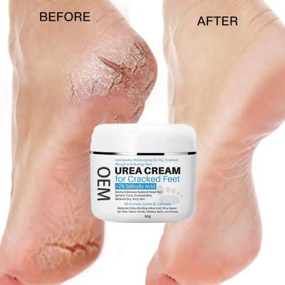 China Moisturzing 2% Natural Organic Salicylic Acid Dead Skin Removal Exfoliating Cracked Heels Urea 40% Foot Cream Hand Treatment and Foot Cream for sale