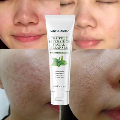 China Acne Treatment Soft Green Tea VC Cleansing Cream Acne Anti Whitening Skin Care Face Wash Cream Facial Massager Detergent for sale