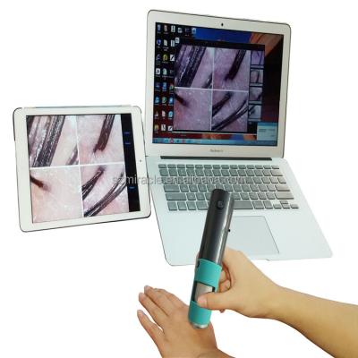 China Other suitable for a variety of Mini System 600X Handheld Scalp Analyzer for sale