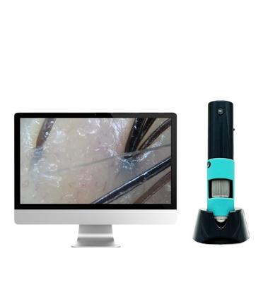 China High Quality Scalp Hair Follicle Hair Analysis Scalp Skin Wrinkle Analysis Scalp Camera 3 Megapixel 600X WiFi Diagnostic Connection To Mobile Phone Tablet for sale