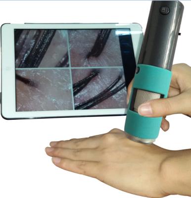 China Take pictures wireless connection phone, tablet, computer, HD scalp detector for sale