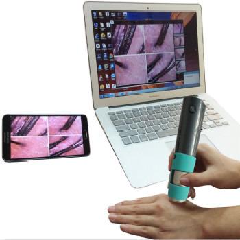 China Take Pictures Selling New For IOS And Android Portable Scalp Detector for sale