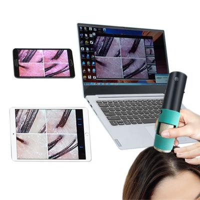 China Portable Mini Pigmentation Analysis Scalp Analyzer Hair Analyzer Can Be Magnified 600 Times For Scalp Hair Care for sale