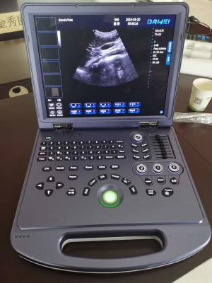 China CE Portable Ultrasonic Diagnostic System 4d Color Doppler Ultrasound 300mm for sale