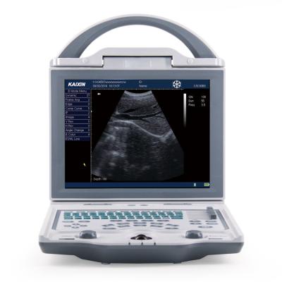 China Diagnostic Medical Ultrasound Machine KX5600 Ultrasound Machine Full Digital B Mode for sale