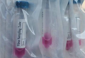 China Virus Transport Media Blood Collection Tube Additives Swab Virus Preservation Solution for sale