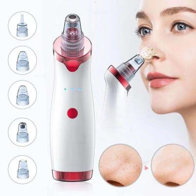 China Home Beauty Personal Care Products Blackhead Vacuum Remover Blackhead Remover Blackhead Vacuum Acne Removal Batch Master Blackhead Removal for sale