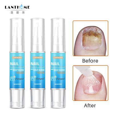 China Butanediol Fungal Lanthome Fungal Nail Treatment Pen 4ml for sale