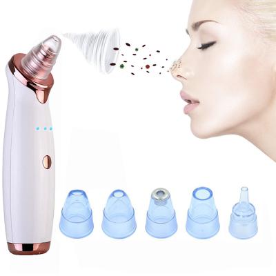 China Black Head Blackhead Pore Vacuum Removal Remover Pores Blackhead Cleaner Vacuum for sale