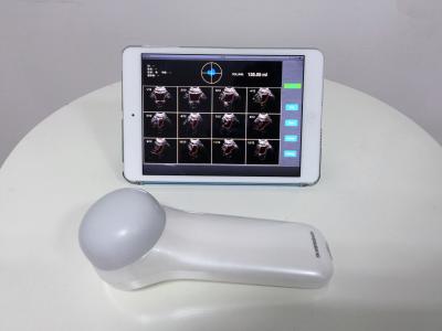 China Portable waterproof 4D wireless bladder scanner bladder shape and size for sale