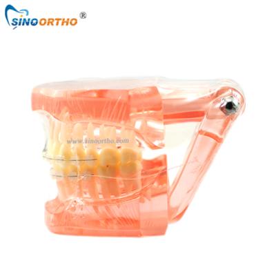 China Sinos Ortho Plastic Dental High Quality Removable Plastic Teeth Model for sale