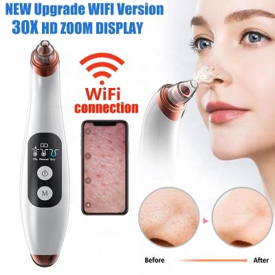 China Acne Treatment Head Blackhead Removedor De Cravos Remover Dropship Acne Treatment CE Blackhead Clear Vacuum With Camera for sale