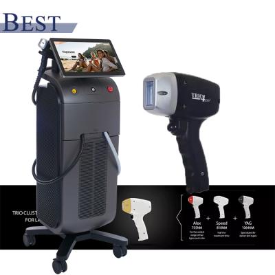 China 2022 Hair Removal Alma Soprano Laser Hair Removal Machine for sale