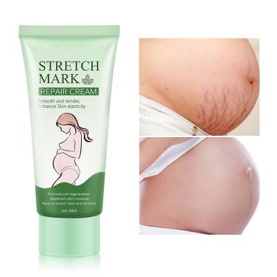 China Baolin OEM Anti Wrinkle Skin Nourishing Anti Aging Maternity Repair Remove Pregnancy Scars Rose Remove Stretch Marks Cream Skin Care for sale