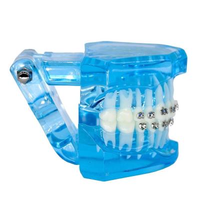 China Orthodontic Teeth Development Model CE Certified ALS Dental Teaching Models with Brackets for sale