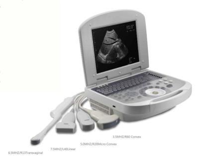 China Convenience Laptop Medical Ultrasound Scanner Machine B/W Portable Echo Instrument For Human Use for sale