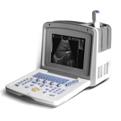 China Portable Metal B/W Ultrasound Scanner Machines For Clinic Hospital To Use Black And White Ultrasound Machines for sale