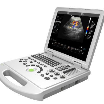 China Metal 15 Inch Screen Laptop Color Doppler Echo Machine Medical Portable Color Doppler Ultrasound Machine for sale