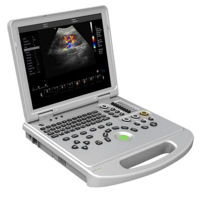 China Hot Sale Portable Metal Laptop Color Doppler System Color Doppler Ultrasound Scanner Machine for sale