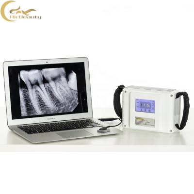 China Dental X-Ray Machine Classic Quality Adjust Portable 60KV Digital Dental X-Ray Machine for sale