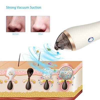 China Electric Derma Exfoliators Suction Vacuum Blackhead Remover Fixed Mini Crystal Diamond Microdermabrasion Machine Handheld Facial Professional for sale