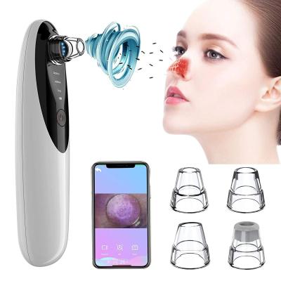 China Acne Treatment Stretching Products 2022 New Arrivals Beauty Equipment Home Use Beauty Personal Care Blackhead Remover Vacuum With Camera for sale